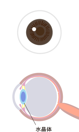 正常な目のイメージ図